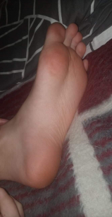 Feet and soles